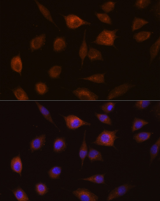 Anti-GSTT1 Antibody (CAB1287)