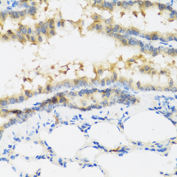 Anti-IFNL3 Antibody (CAB5648)