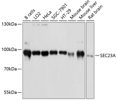 Anti-SEC23A Antibody (CAB12101)