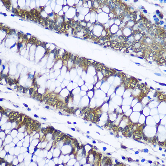 Anti-Ubiquitin Antibody (CAB2129)