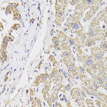 Anti-MDH2 Antibody (CAB6297)