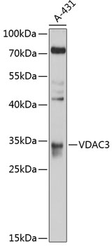 Anti-VDAC3 Antibody (CAB10544)