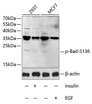 Anti-Phospho-Bad-S136 Antibody (CABP0011)