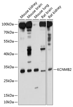 Anti-KCNMB2 Antibody (CAB10277)