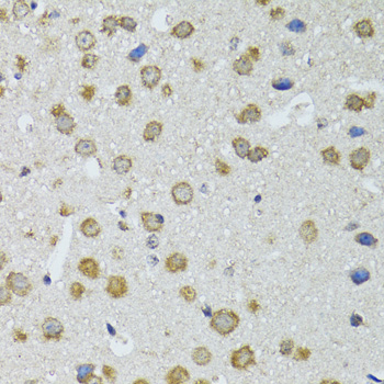 Anti-RNASEL Polyclonal Antibody (CAB9840)