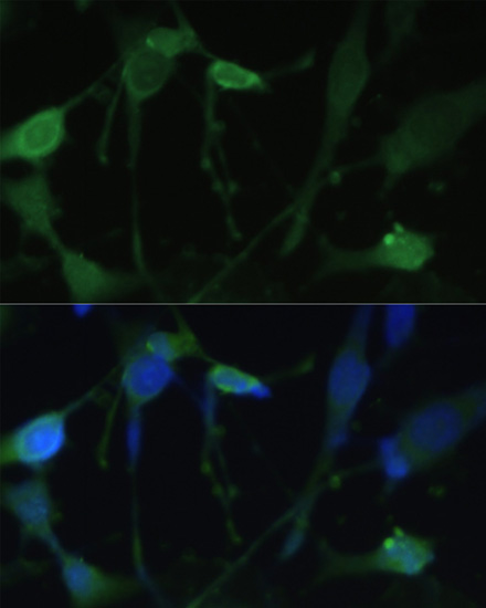 Anti-FABP7 Antibody (CAB11604)