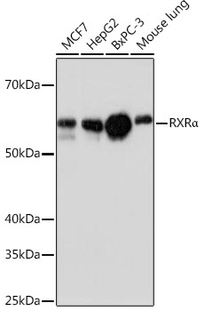 Anti-RXRAlpha Antibody (CAB19105)