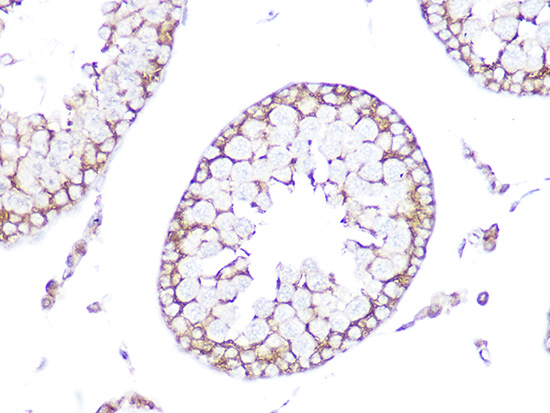 Anti-Tubulin alpha 1b Antibody