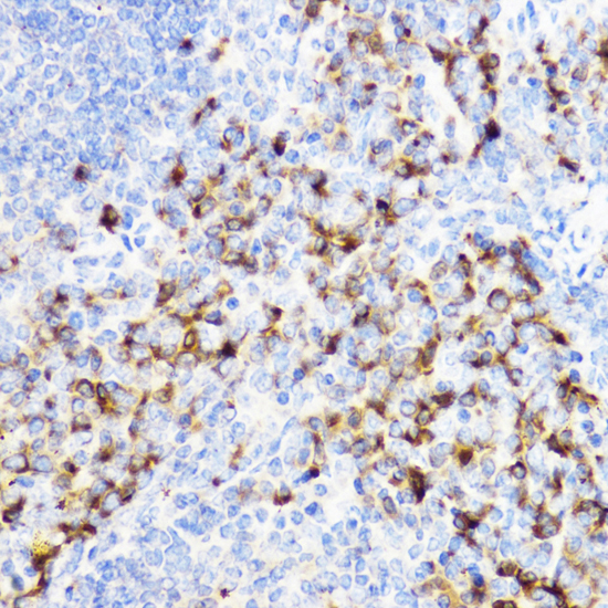 Anti-YKL-40 / CHI3L1 Antibody (CAB1723)