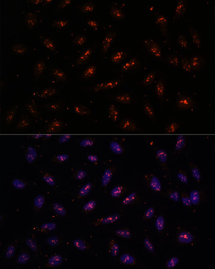 Anti-DNTTIP2 Antibody (CAB16120)