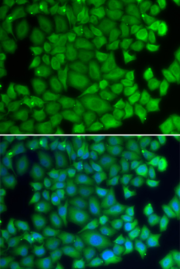 Anti-HSPB2 Antibody (CAB2350)