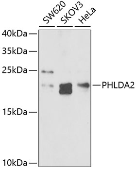 Anti-PHLDA2 Antibody (CAB6244)