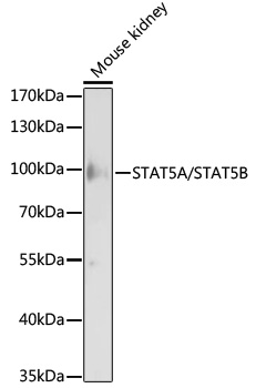 Anti-STAT5A/STAT5B Antibody (CAB17930)