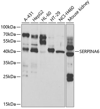 Anti-SERPINA6 Antibody (CAB13609)