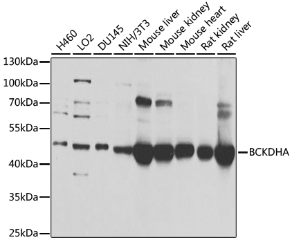 Anti-BCKDHA Polyclonal Antibody (CAB9806)