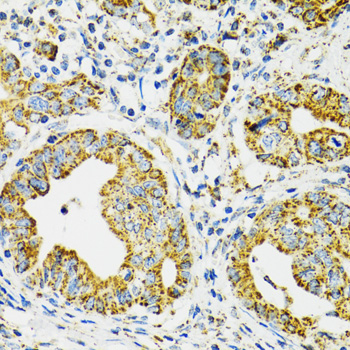Anti-HSPA9 Antibody (CAB0558)