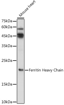 Anti-Ferritin Heavy Chain Antibody (CAB1144)