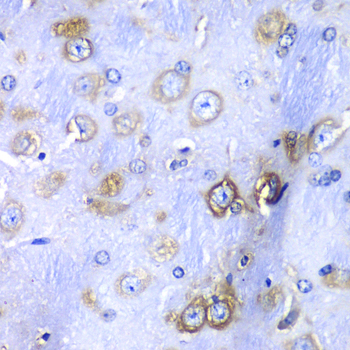 Anti-RPS3A Antibody (CAB5885)