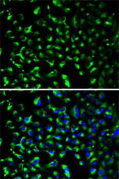 Anti-PHB Antibody (CAB13526)