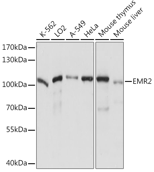 Anti-EMR2 Antibody (CAB14278)