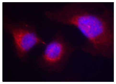 Anti-Phospho-SYK-Y323 Antibody (CABP0291)