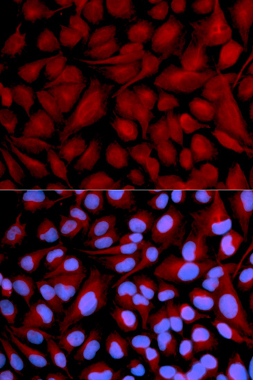 Anti-CASK Antibody (CAB2501)