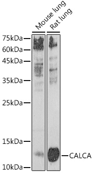 Anti-CALCA Antibody (CAB16786)