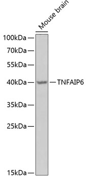 Anti-TNFAIP6 Antibody (CAB6419)