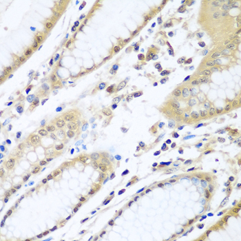 Anti-WDR48 Antibody (CAB6854)