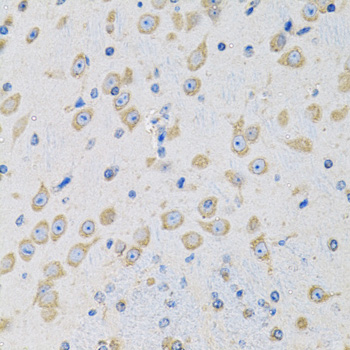 Anti-MSRA Antibody (CAB6389)