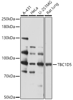 Anti-TBC1D5 Antibody (CAB17059)
