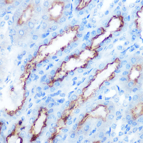 Anti-PDGFA Antibody (CAB17434)