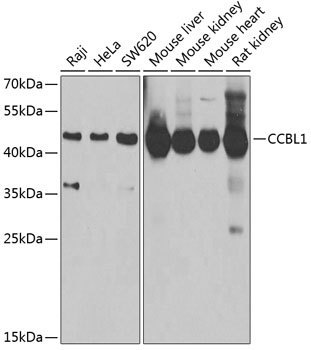 Anti-CCBL1 Antibody (CAB6542)