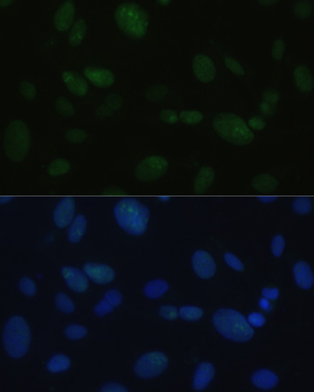 Anti-PRKDC Antibody (CAB7716)