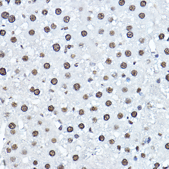 Anti-Twist Antibody [KO Validated] (CAB15596)