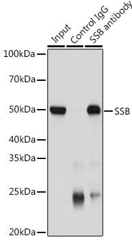 Anti-SSB Antibody (CAB0630)