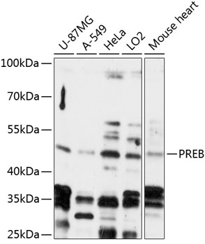 Anti-PREB Antibody (CAB14347)