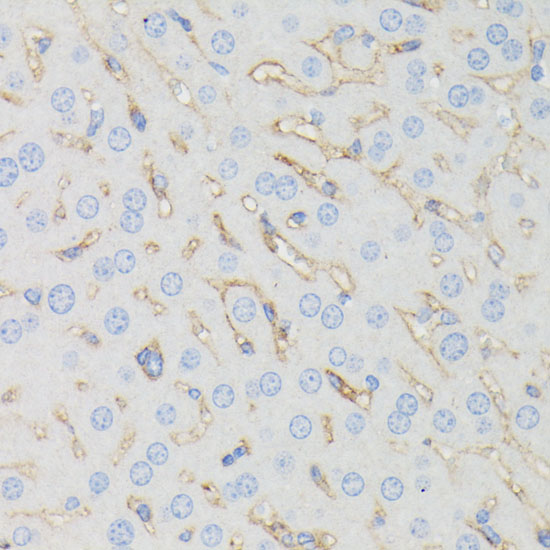 Anti-IFITM1 Antibody (CAB4228)