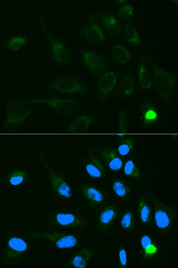 Anti-UGT1A9 Antibody (CAB1661)