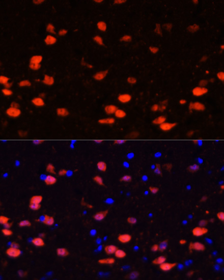 Anti-Calretinin Polyclonal Antibody (CAB9807)