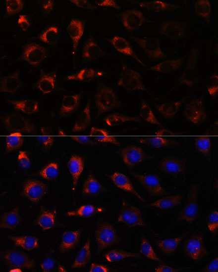 Anti-CYP17A1 Antibody (CAB1373)