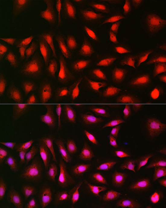 Anti-p70 S6 kinase Antibody (CAB2190)