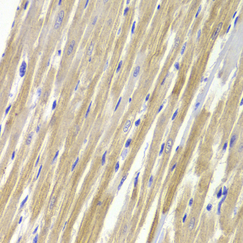 Anti-GPD1 Antibody (CAB5715)