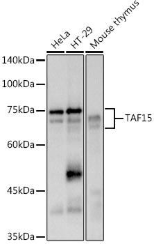 Western blot analysis of extracts of various cell lines, using at 1:500 dilution. Secondary antibody: HRP Goat Anti-Rabbit IgG (H+L) at 1:10000 dilution. Lysates/proteins: 25ug per lane. Blocking buffer: 3% nonfat dry milk in TBST. Detection: ECL Basic Kit. Exposure time: 1s.