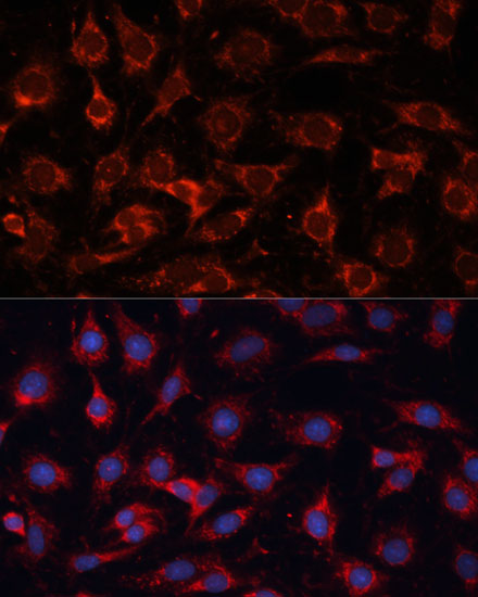 Anti-PDHA2 Polyclonal Antibody (CAB9943)