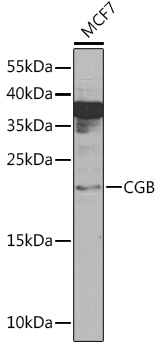 Anti-CGB Antibody (CAB12419)