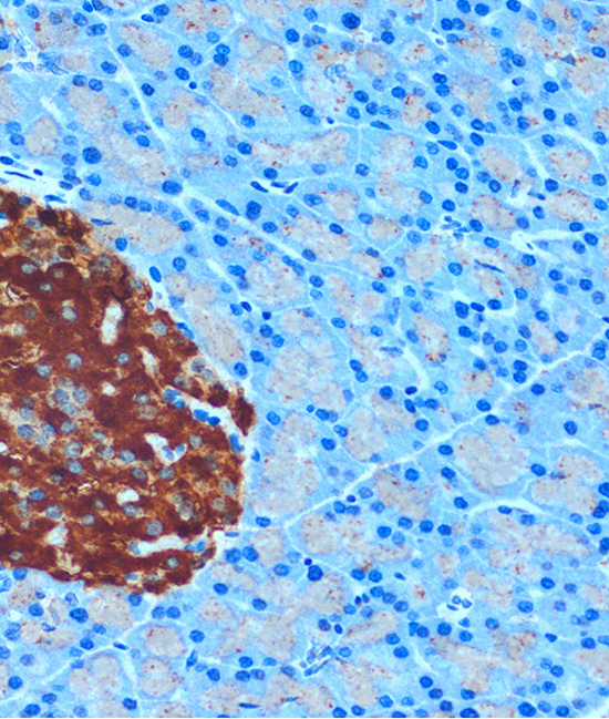 Anti-SCGN Antibody (CAB12897)