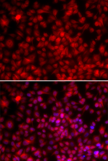 Anti-ILF2 Antibody (CAB13320)