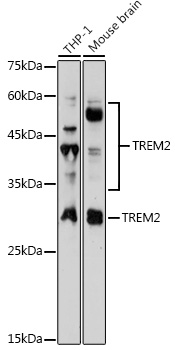 Anti-TREM2 Antibody (CAB10482)