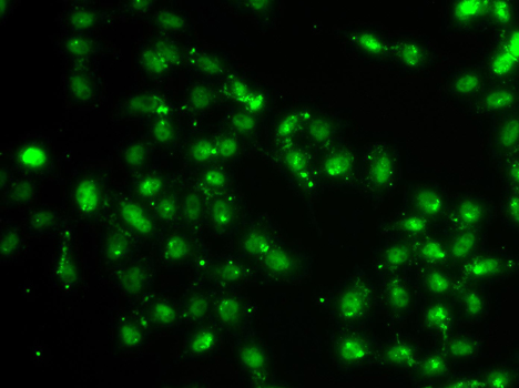 Anti-L3MBTL1 Antibody (CAB7090)